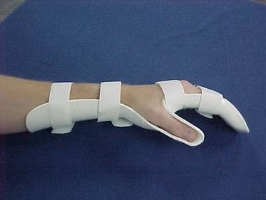 RD - Physio musculoskeletal physiotherapy - Sports Injury Clinics in hull