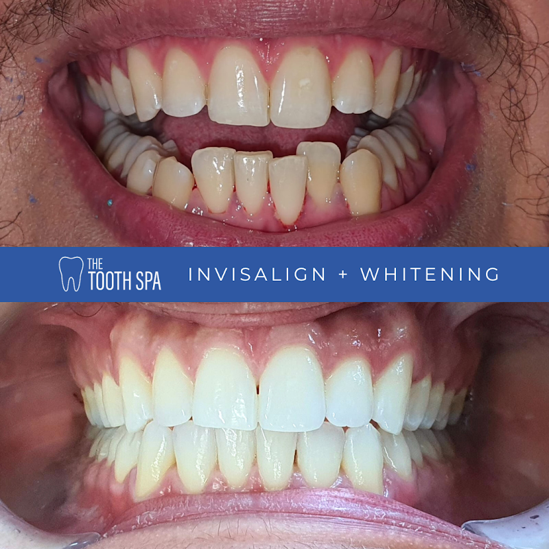 The Tooth Spa