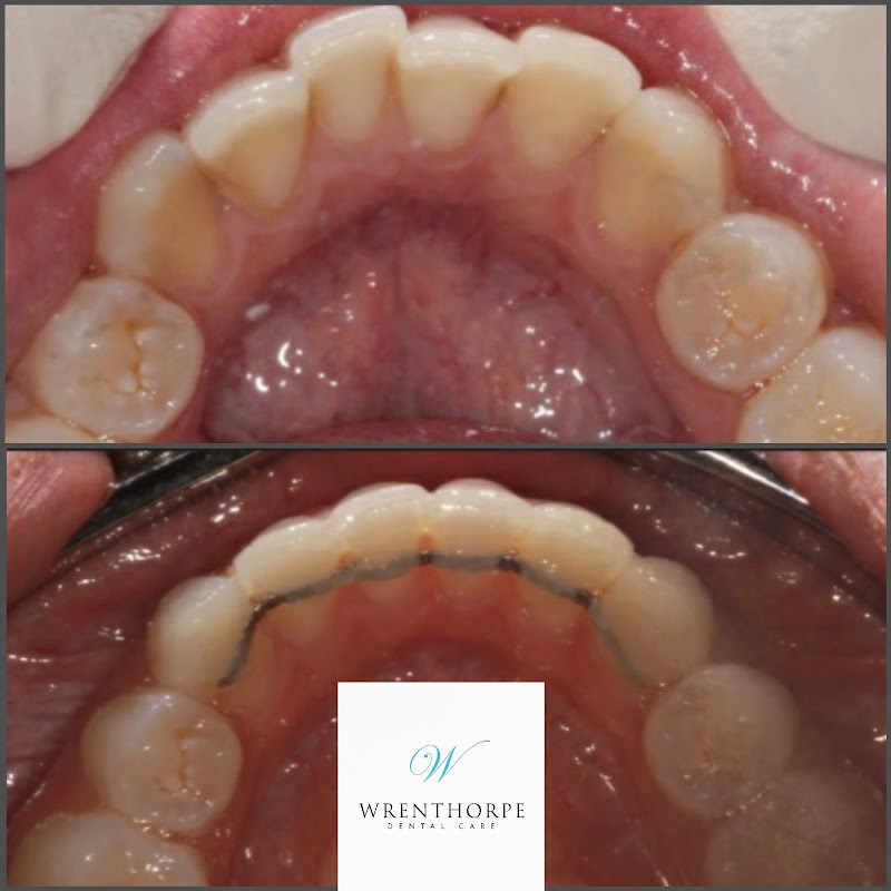 Wrenthorpe Dental Care - Dentists in wakefield