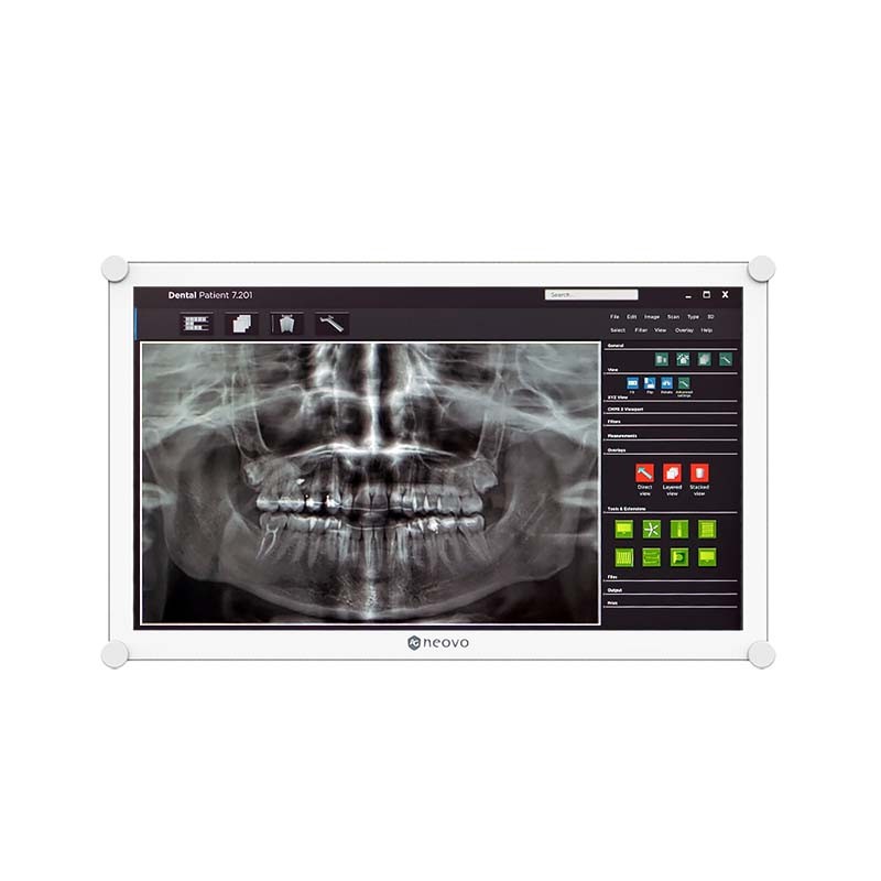 AG Neovo DR-2202 monitor features a sleek black frame, 21.5-inch display with 1920 x 1080 resolution, and is designed for professional use, showcasing a dental X-ray image.