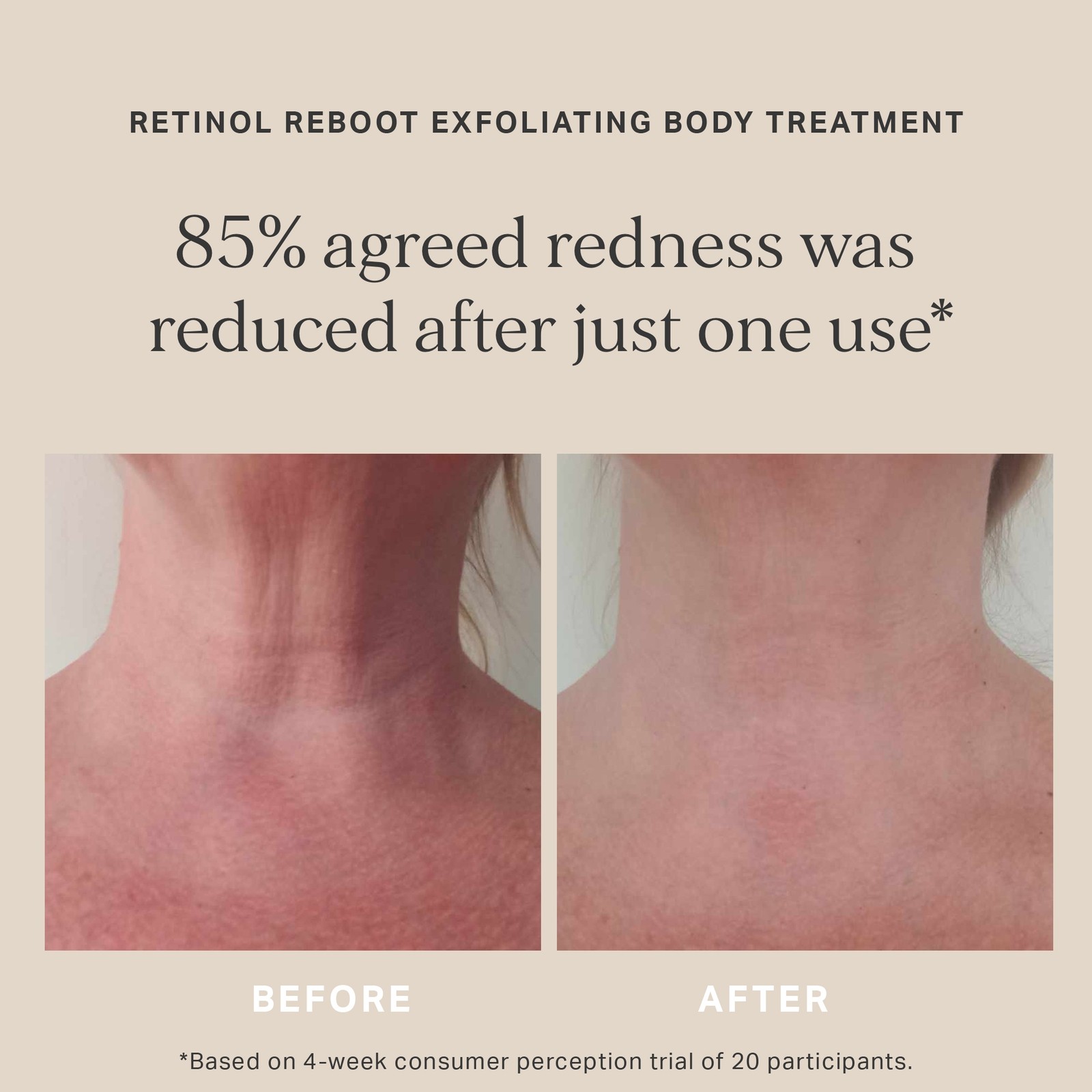 Alpha-H Retinol Reboot Exfoliating Body Treatment 120ml - image 3