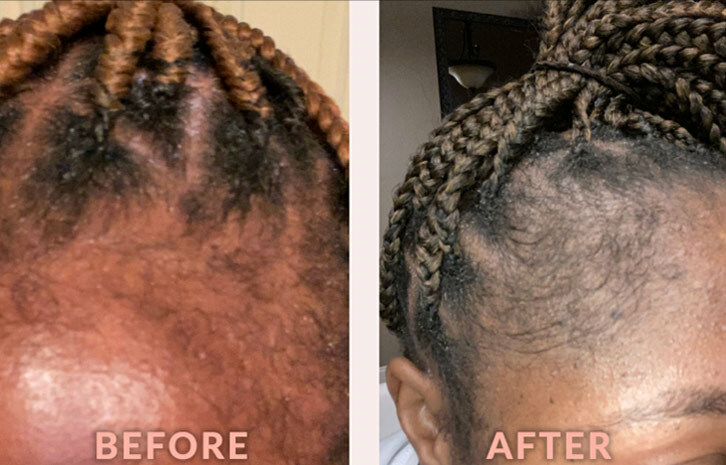 Design Essentials Edge & Temple Strengthening Oil With Biotin & Black Castor Oil 118ml - image 4