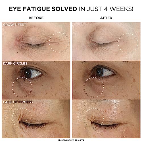IT Cosmetics Confidence in an Eye Cream – 30ml | Hydrates Under‑Eyes | Softens Fine Lines | Reduces Puffiness - image 3