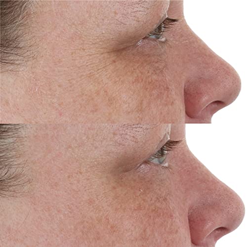 Perricone MD High Potency Retinol Recovery Overnight Moisturiser - image 3