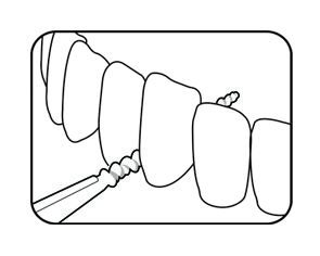 TePe EasyPick Toothpick Medium/Large 36 Pieces - image 3
