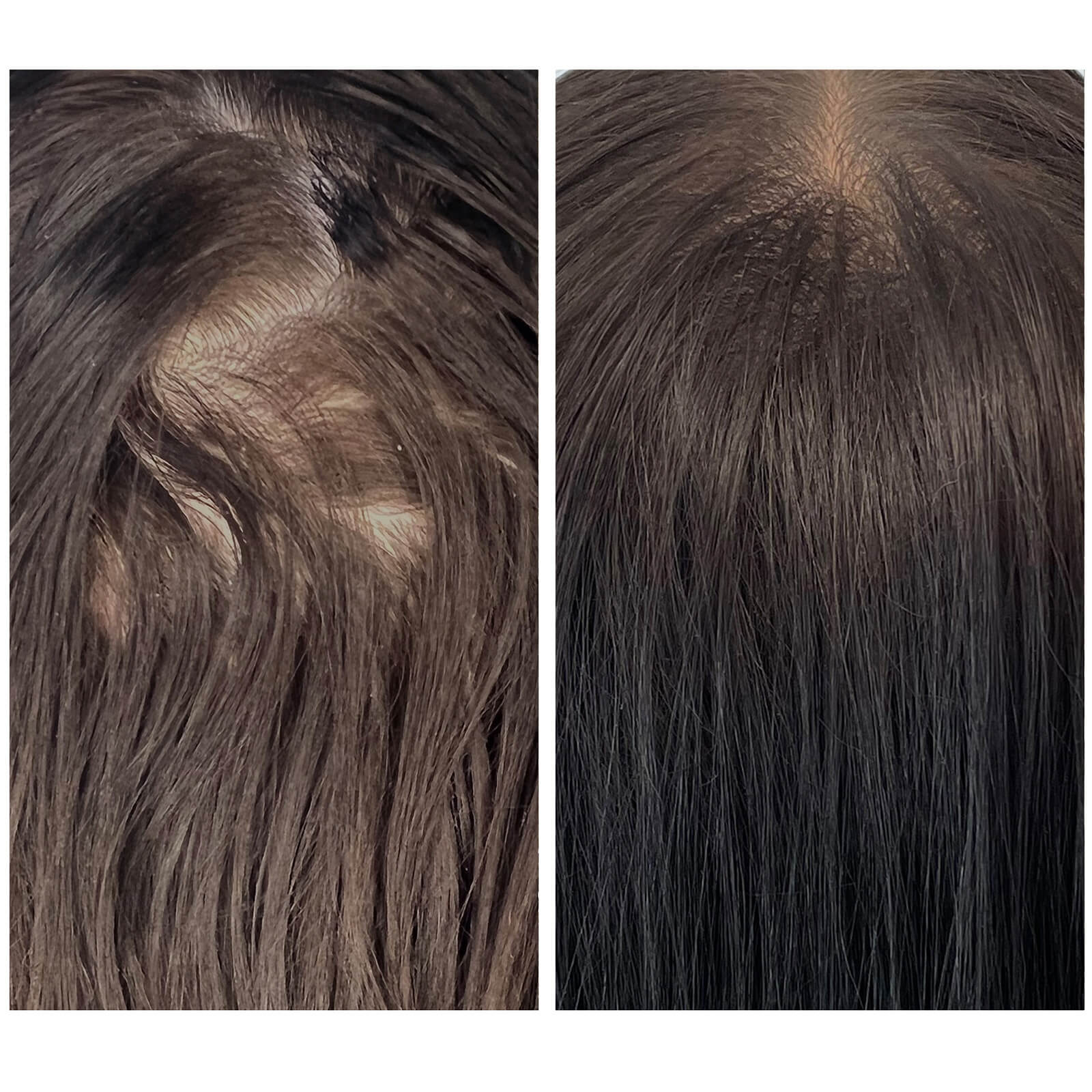 WE ARE PARADOXX Growth Accelerate Advanced Scalp Serum 50ml - image 2