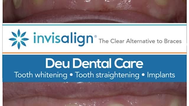 Deu Dental Care - Dentists in headingley
