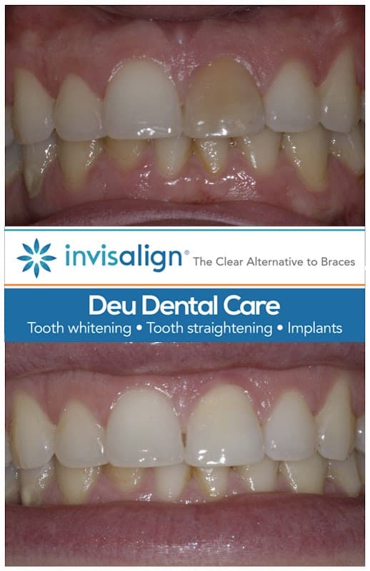 Deu Dental Care