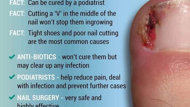 Podiatry and Gait Clinic - Helmsley - Sports Injury Clinics in helmsley
