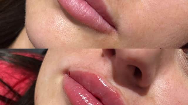 The Aesthetics Lounge - Beauty Salons in redcar