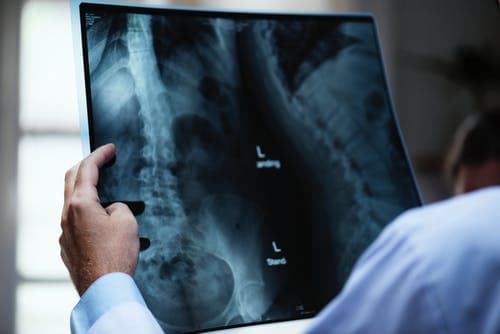 Boroughbridge Chiropractor & Back Pain Clinic