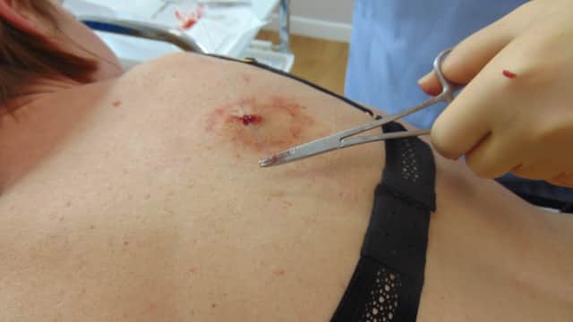 Decyst Clinic - Doctors in brough