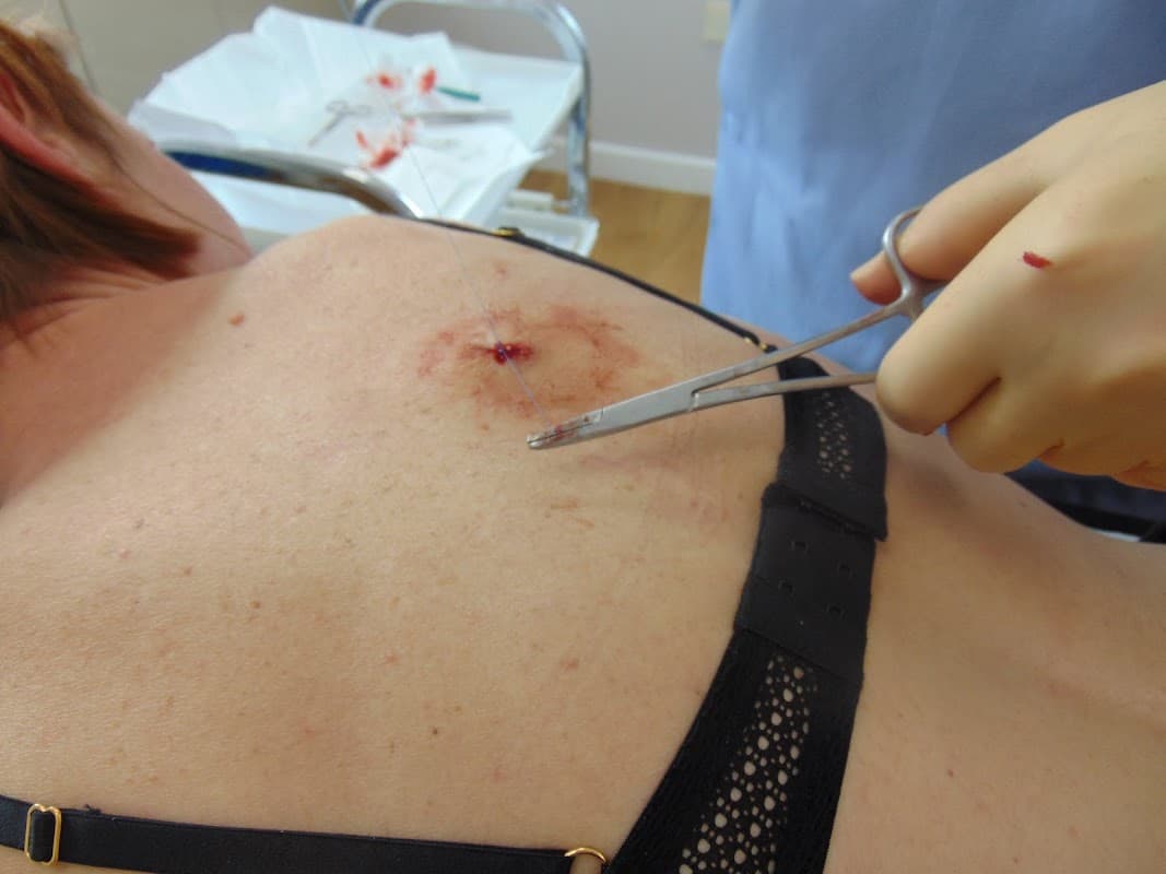 Decyst Clinic