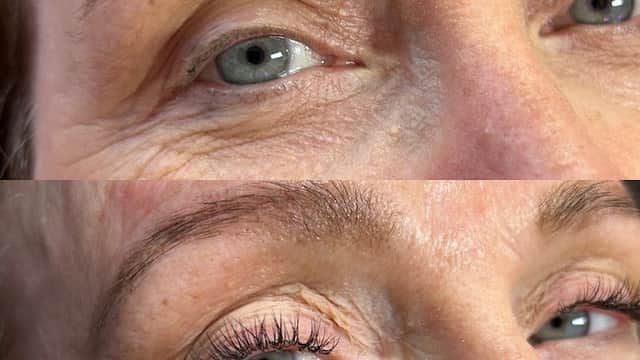 Close-up of a woman's eyes before and after eyelash enhancement, showcasing natural and enhanced lashes.