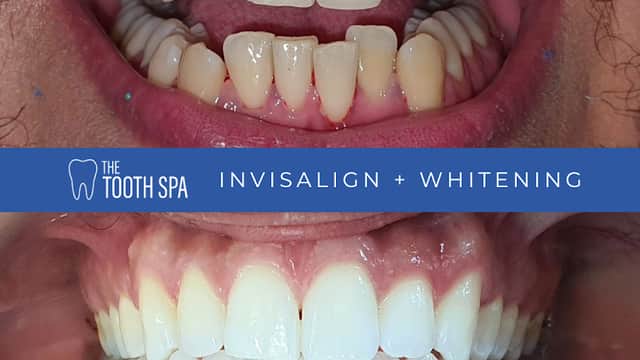 The Tooth Spa - Dentists in leeds