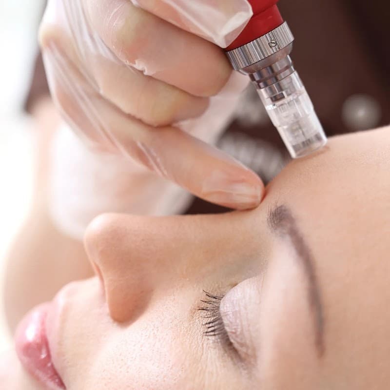 VB Treatments