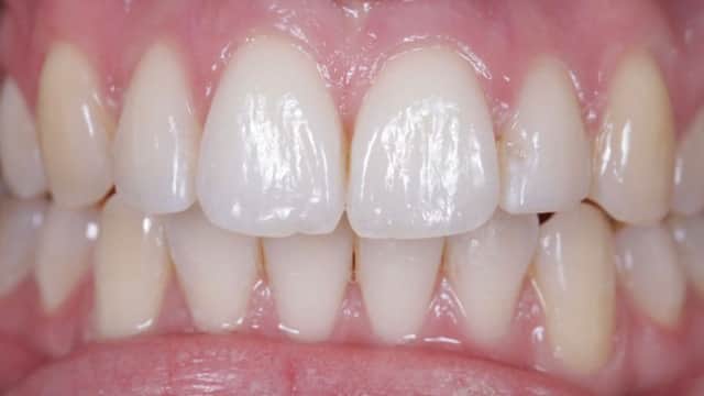 garforth dental - Invisalign Leeds - Dentists in garforth