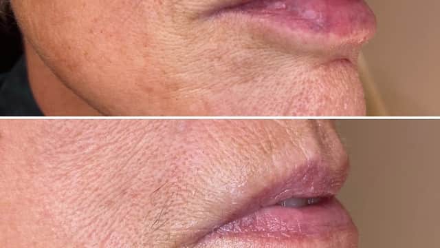 Lopez home injectables - Spa in hessle