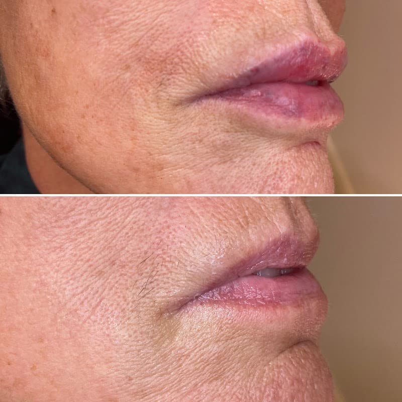 Lopez home injectables