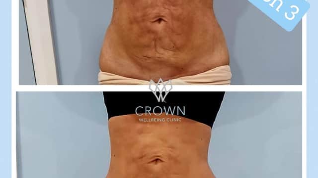 Crown Wellbeing Clinic - Spa in pontefract