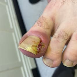 Podocare Podiatry and Chiropody Service