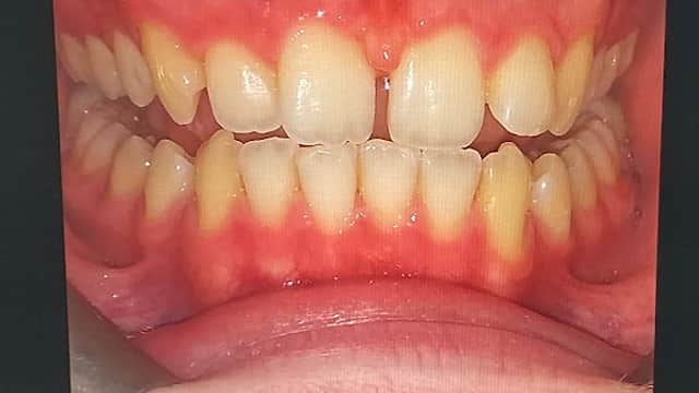 Smile Clinic Leeds - Dentists in headingley