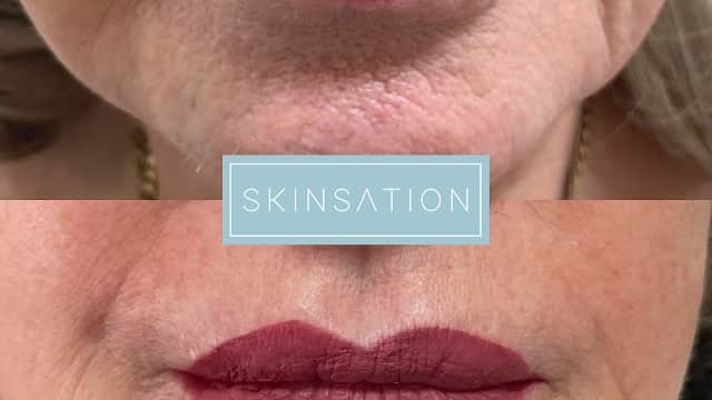 SkinSation - Beauty Salons in wetherby