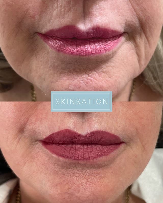 SkinSation