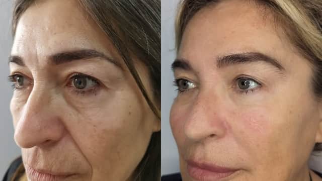 Pure Skin Clinic - Beauty Salons in harrogate