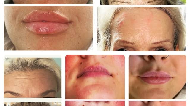 Perfect luxe aesthetics - Beauty Salons in catterick garrison