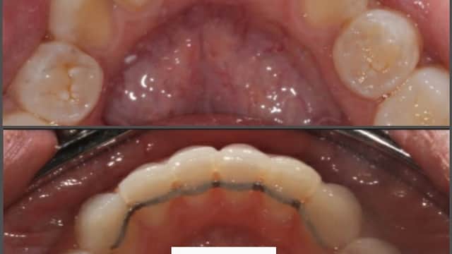 Wrenthorpe Dental Care - Dentists in wakefield