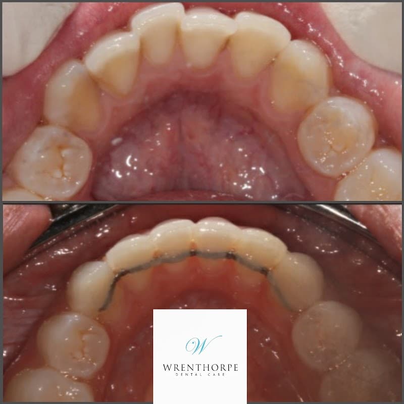 Wrenthorpe Dental Care