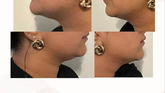 Luxe Beauty Clinic - Beauty Salons in batley