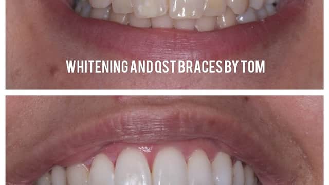 Rayner Dental Practice Wibsey - Dentists in bradford